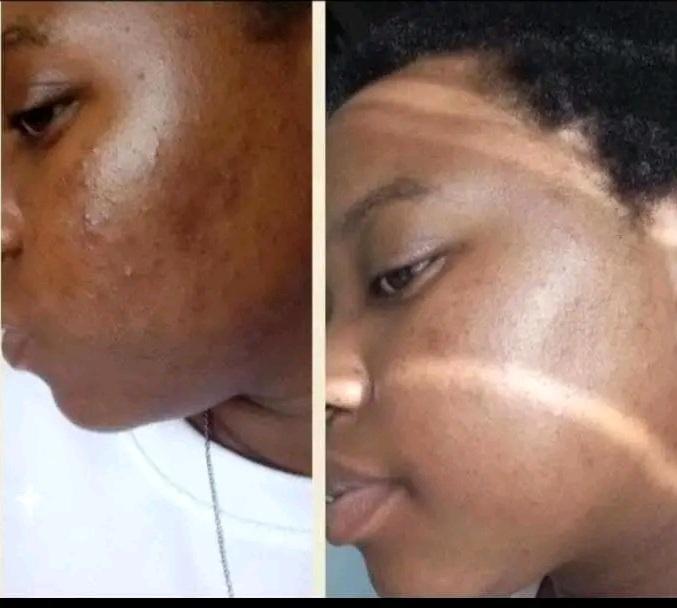 Skin before and after